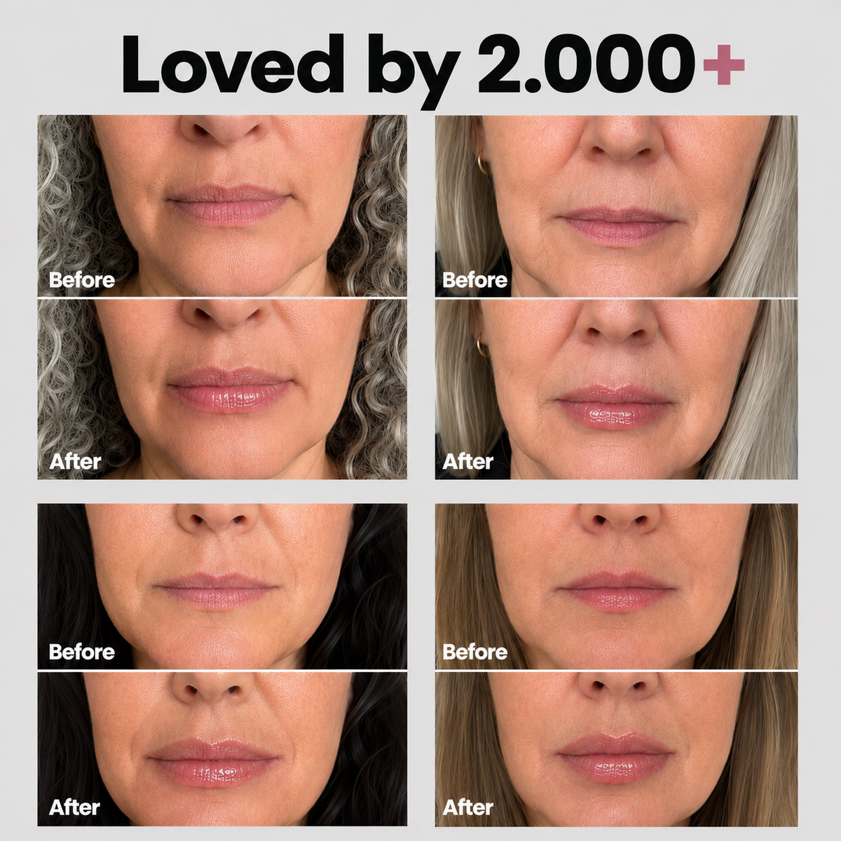 Lip Plumper